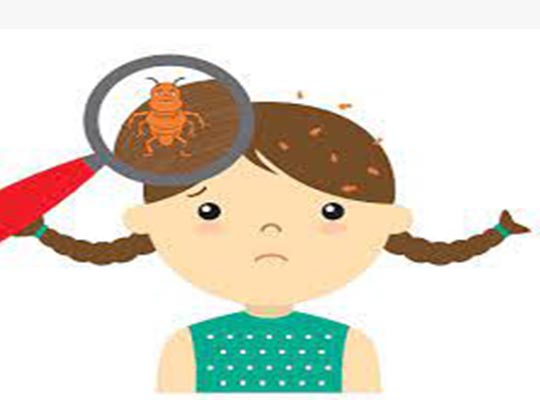 Epidemiology of head lice infestation